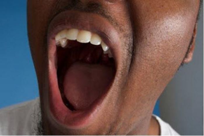 Bad breath (Leapfame)