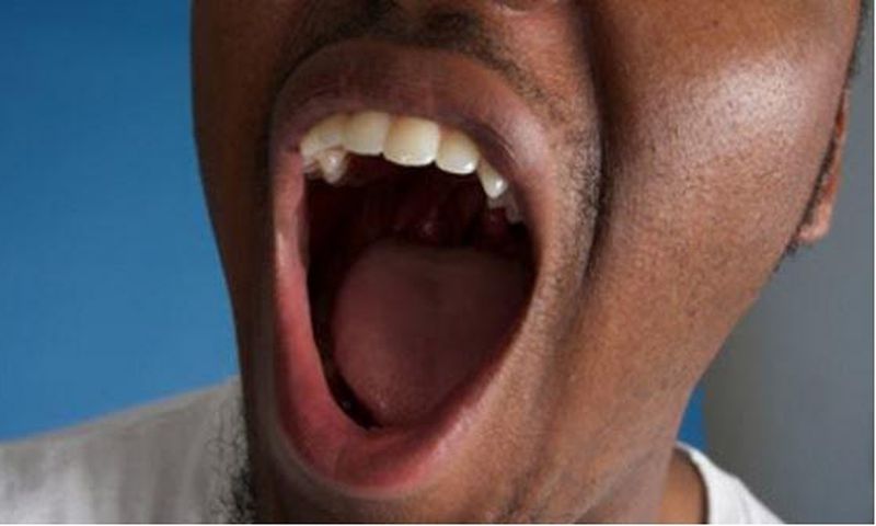 Bad breath (Leapfame)