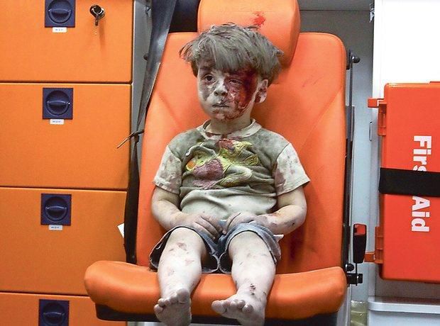 Viral photo of 5-year-old Omran Daqneesh who was injured after an air strike in Aleppo in August 2016