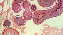 What You Need To Know About The Gaps Diet