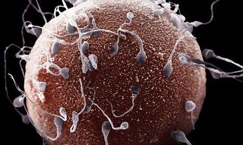 ___5666917___https:______static.pulse.com.gh___webservice___escenic___binary___5666917___2016___10___27___14___semen+2