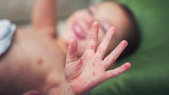 Unvaccinated children cannot return to school [fatherly]