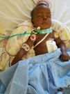 Baby Neillah Mirera at the Nairobi Hospital, she can no longer feed through the mouth or breathe through her nose