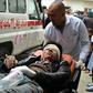 A wounded Afghan man is transferred from an ambulance to hospital after a bombing at a Shiite mosque in Kabul on November 21, 2016