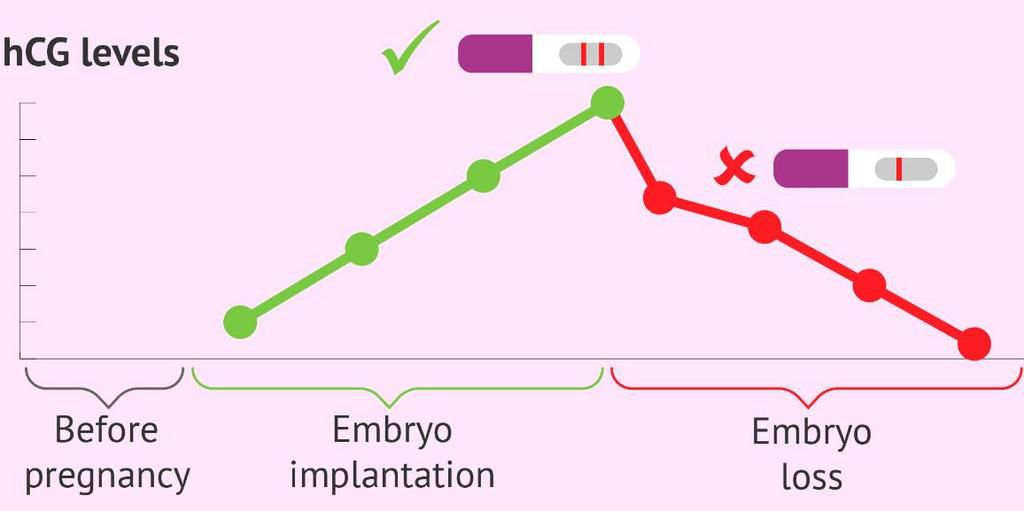 Chemical Pregnancy HCG Levels(Soca Pregna)