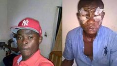 Before and after photo of the victim