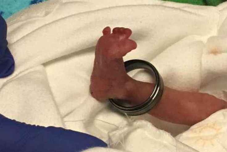 ___5716575___https:______static.pulse.com.gh___webservice___escenic___binary___5716575___2016___11___6___16___small+baby