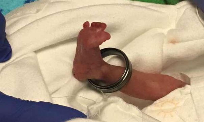 ___5716575___https:______static.pulse.com.gh___webservice___escenic___binary___5716575___2016___11___6___16___small+baby