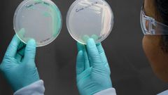 How a Chicago Woman Fell Victim to Candida Auris, a Drug-Resistant Fungus