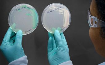 How a Chicago Woman Fell Victim to Candida Auris, a Drug-Resistant Fungus