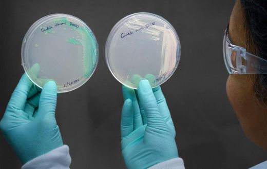 How a Chicago Woman Fell Victim to Candida Auris, a Drug-Resistant Fungus