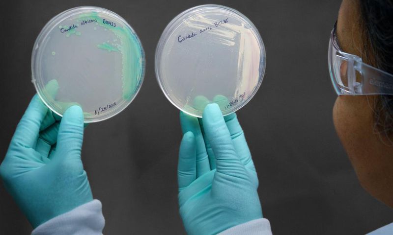 How a Chicago Woman Fell Victim to Candida Auris, a Drug-Resistant Fungus