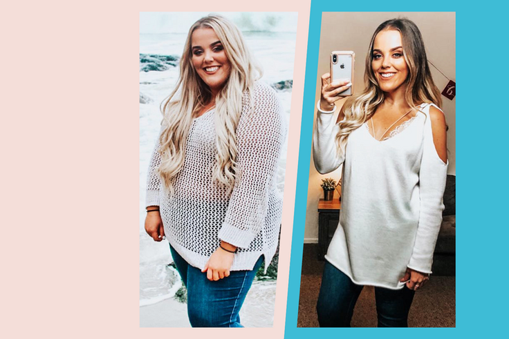 'I Lost 150 Pounds After Gastric Bypass'