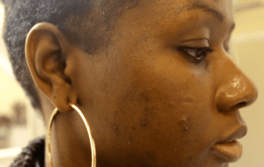 Signs you're using too many skincare products (Image Lisa a la mode)