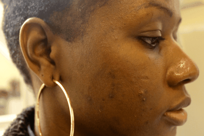 Signs you're using too many skincare products (Image Lisa a la mode)