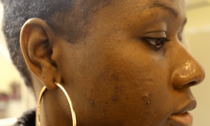 Signs you're using too many skincare products (Image Lisa a la mode)