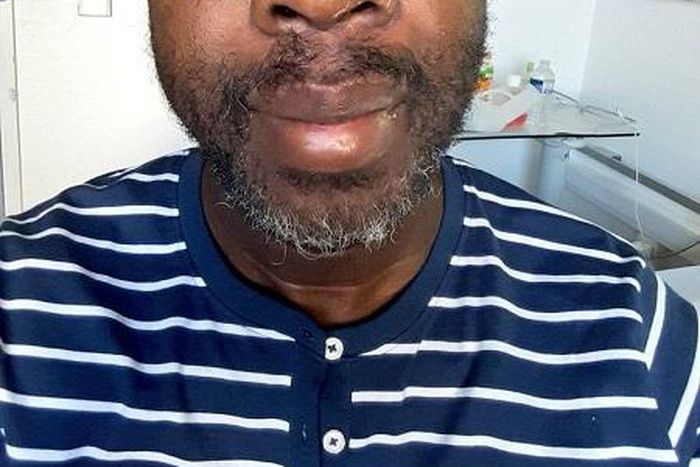 Photo shared by Kibra MP Ken Okoth after undergoing treatment for Colorectal Cancer (Twitter)