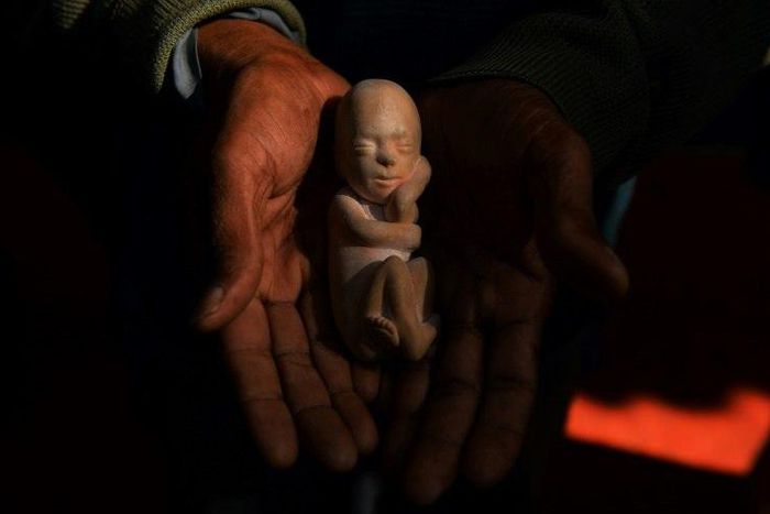 An Indian activist holds a model of a foetus during a protest against abortion in New Delhi