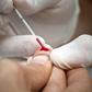 Europe registered its highest number of new HIV cases in a single year in 2015, at 153,407 cases, up from 142,000 in 2014, the WHO said