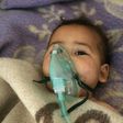 Dozens of people, including children, suffered breathing problems after the suspected chemical attack