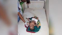 The eight-month-old baby pictured with the knife sticking out of his stomach