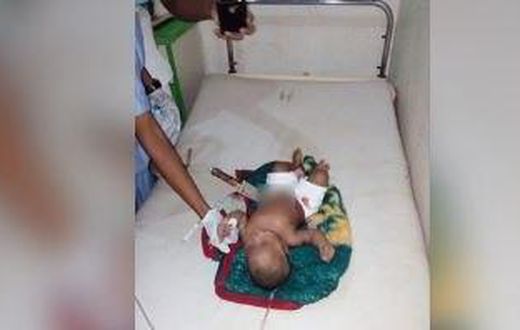 The eight-month-old baby pictured with the knife sticking out of his stomach