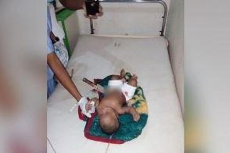 The eight-month-old baby pictured with the knife sticking out of his stomach