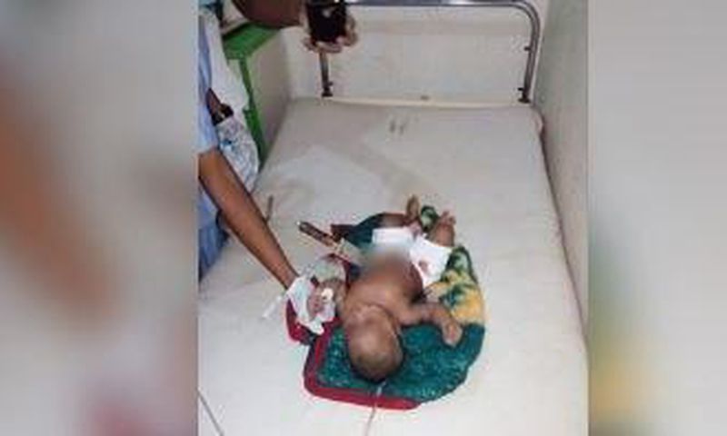 The eight-month-old baby pictured with the knife sticking out of his stomach