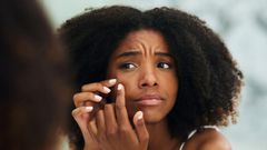 Blackheads do's and don'ts (blackenterprise)