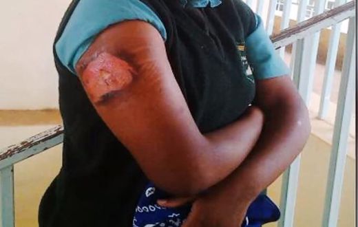 File image of a viral photo of a student nursing injuries Evans Bosire believes that the photo could be of his daughter at Nyanururu girls school