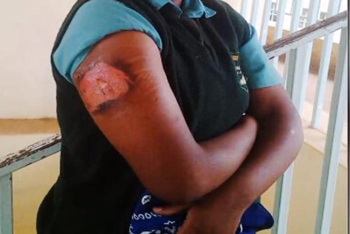 File image of a viral photo of a student nursing injuries Evans Bosire believes that the photo could be of his daughter at Nyanururu girls school