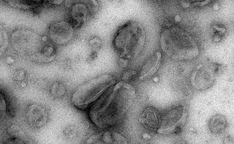 Cancer's Trick for Dodging the Immune System