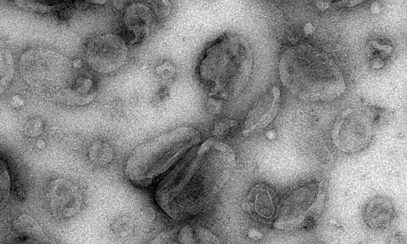 Cancer's Trick for Dodging the Immune System