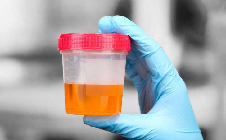 Urine can indicate if you have health issues