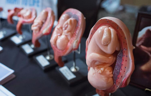 Unsafe abortions are rampant in Kenya