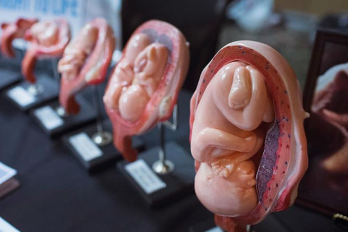 Unsafe abortions are rampant in Kenya