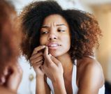 How to use toothpaste to get rid of pimples