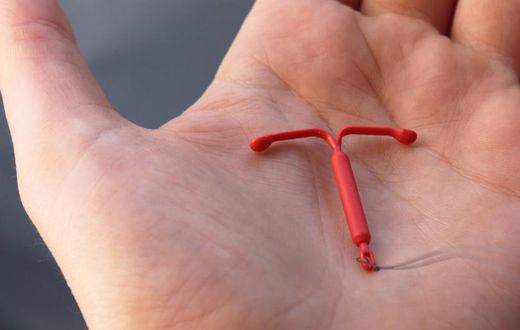 IUD(Insider)