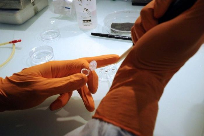 New studies offer hope that stem cell therapy could help men unable to have an erection after prostate surgery to enjoy a normal sex life