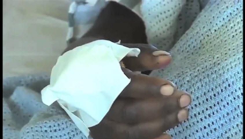 Peninah Wangeci's hand while in the hospital bed at Karatina Sub-county Hospital (Citizen)