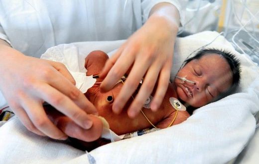 An artificial womb, tested on pre-natal lambs, could help extremely premature babies avoid death or disability