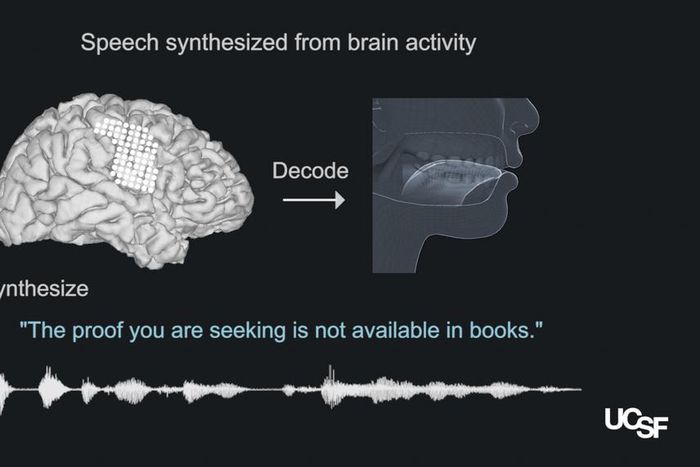 Scientists Create Speech From Brain Signals
