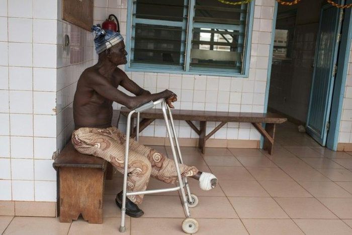 A man who lost his left foot to leprosy, waits for treatment at the Raoul Follereau Foundation facility in Pobe