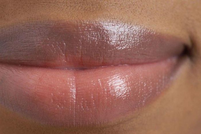 Dark lips can also be triggered by skin disorders, chemical and other lifestyle factors