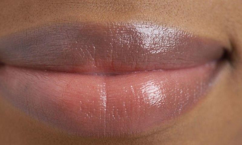 Dark lips can also be triggered by skin disorders, chemical and other lifestyle factors