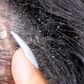 Causes of dandruff on your hair (YouTube)