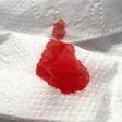 Blood like discharge(Cell Code)