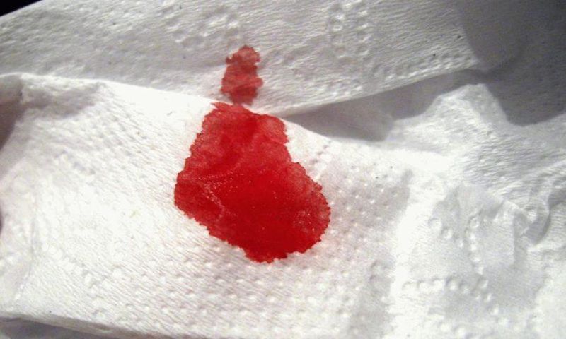Blood like discharge(Cell Code)