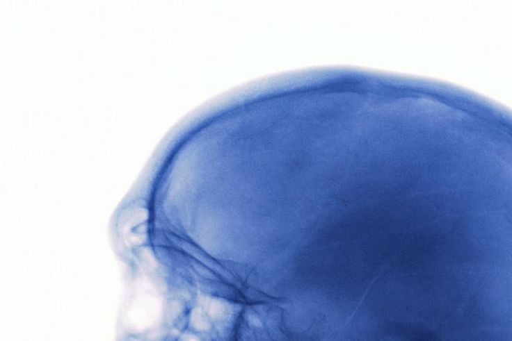 What to Do When You Hit Your Head Really Hard