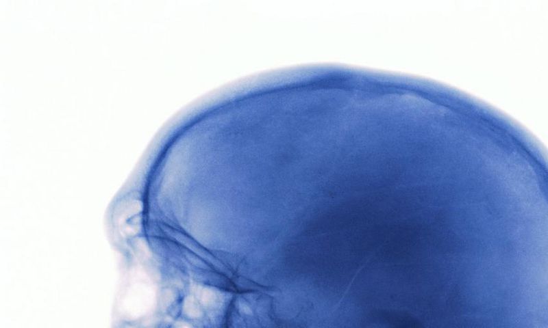 What to Do When You Hit Your Head Really Hard